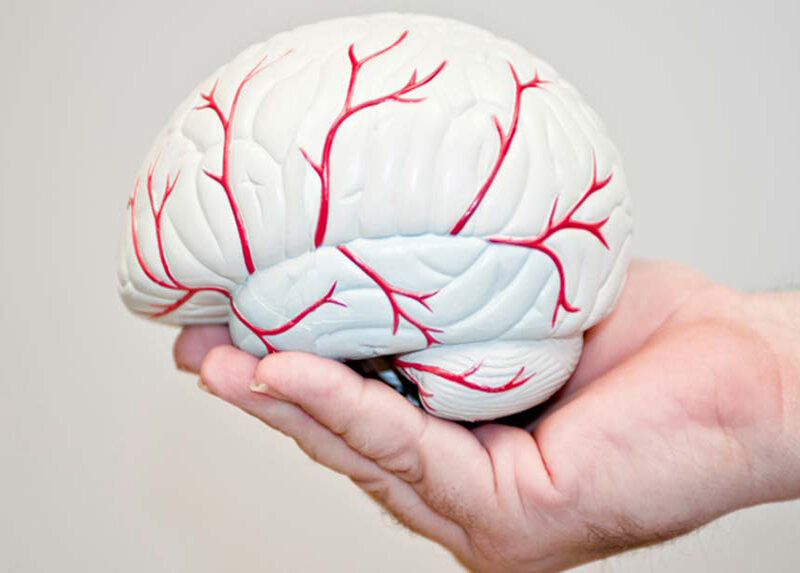 از دست دادن حافظه پس از سکته مغزی در برخی بیماران برطرف می شود