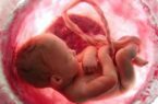 قرارگیری مادر باردار در معرض آلودگی هوا به رشد جنین آسیب می رساند